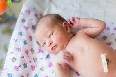Baby liegt kurz nach der Geburt auf dem Rücken. Der Clip versiegelt noch den Rest, der abgeschnittenen Nabelschnur.