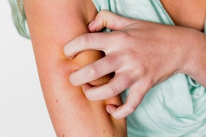 Nahaufnahme von einem Arm, an dem gekratzt wird Nahaufnahme von einem Arm, an dem gekratzt wird